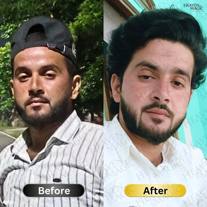 Before and After 2