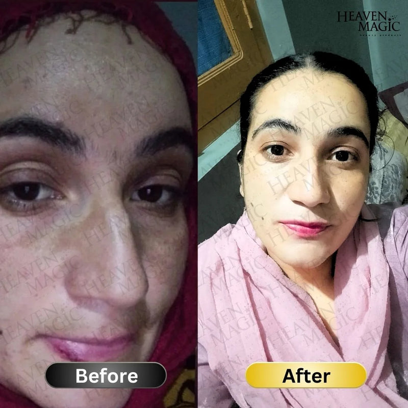 glutathione pictures before and after Serum Before and After Glutathione: How