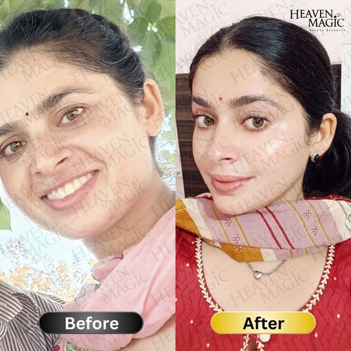 SPECIAL  Pigmentation & Glow  Combo | Night Cream + Vitamin C Serum