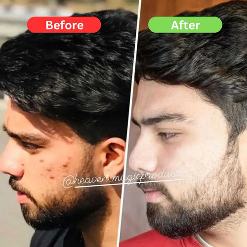 Maha Pigmentation and Glow Bundle Kit