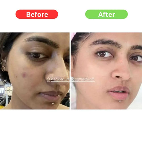 Maha Pigmentation and Glow Bundle Kit