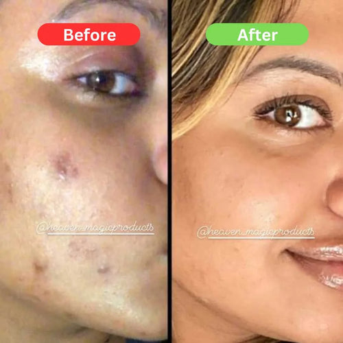 Maha Pigmentation and Glow Bundle Kit