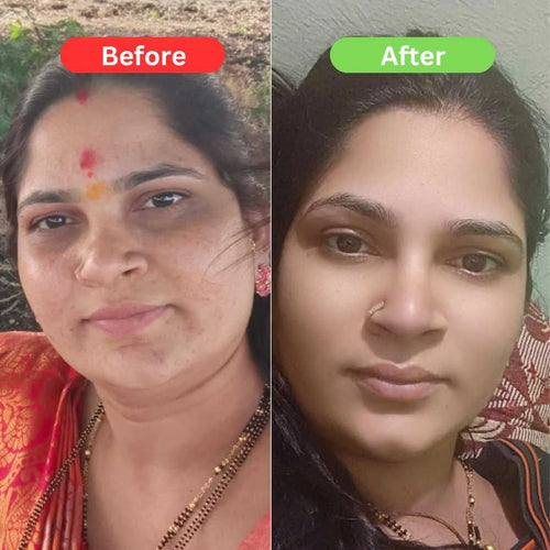 Heaven Magic Glow & Bridal Care Combo | Bridal Super Powerful Cream + Glow Cream