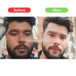 Maha Pigmentation and Glow Bundle Kit - Image 13