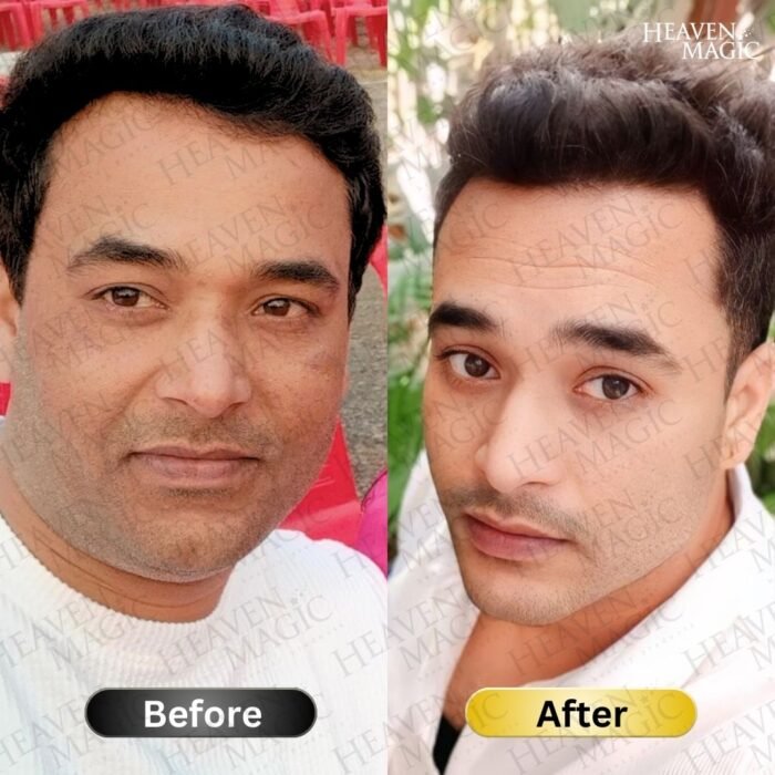 SPECIAL  Pigmentation & Glow  Combo | Night Cream + Vitamin C Serum - Image 11