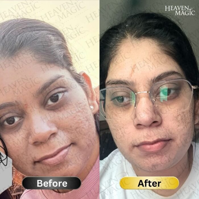 SPECIAL  Pigmentation & Glow  Combo | Night Cream + Vitamin C Serum - Image 12