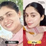 SPECIAL  Pigmentation & Glow  Combo | Night Cream + Vitamin C Serum - Image 6