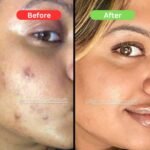 Maha Pigmentation and Glow Bundle Kit - Image 4