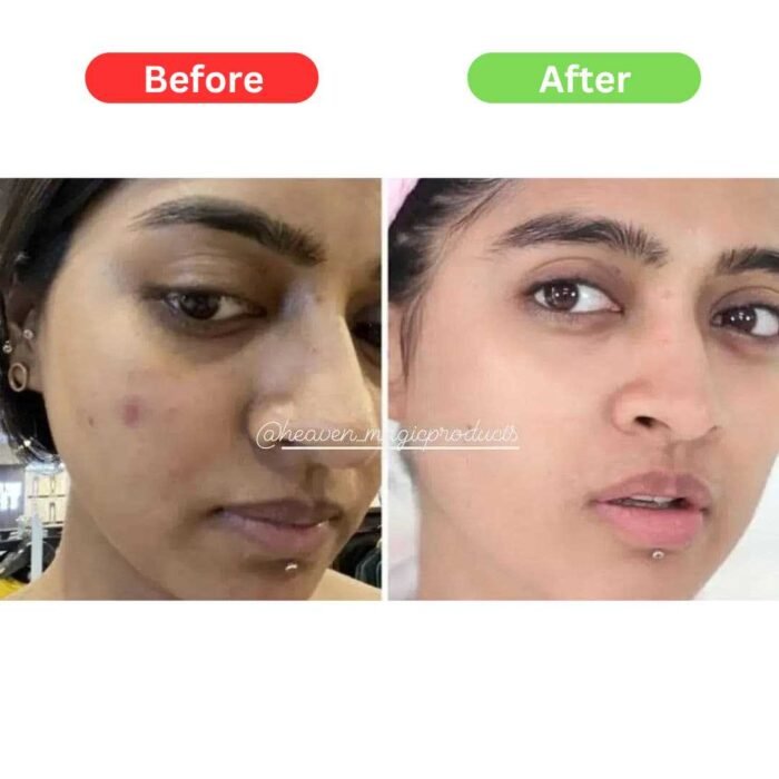 Maha Pigmentation and Glow Bundle Kit - Image 6