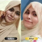 SPECIAL  Pigmentation & Glow  Combo | Night Cream + Vitamin C Serum - Image 14