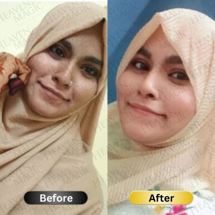 SPECIAL  Pigmentation & Glow  Combo | Night Cream + Vitamin C Serum - Image 14