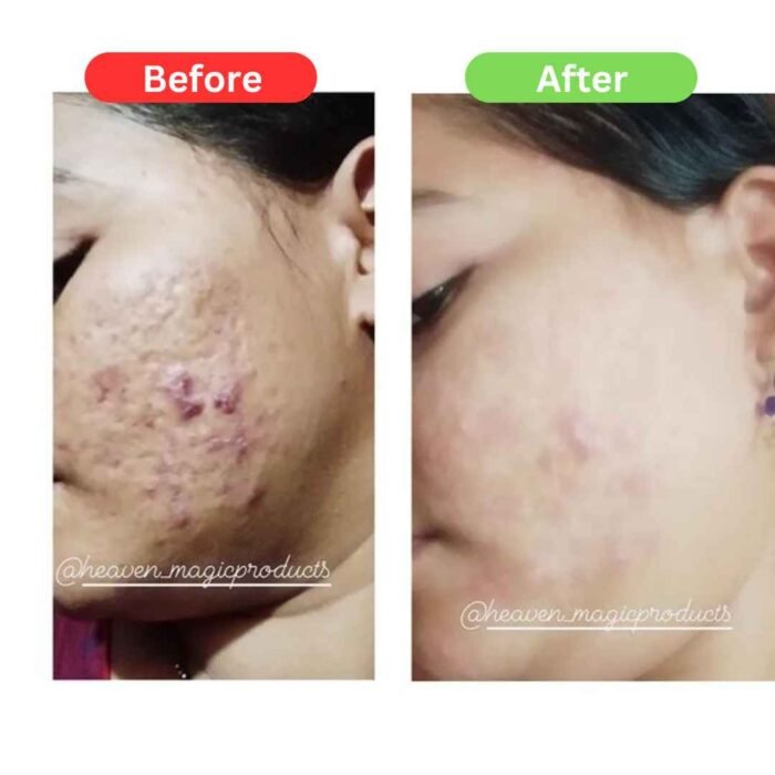 Maha Pigmentation and Glow Bundle Kit - Image 14